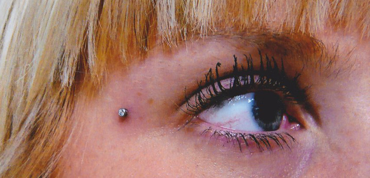Microdermal piercing : 미세 박피술을 만드는 방법 (사진)