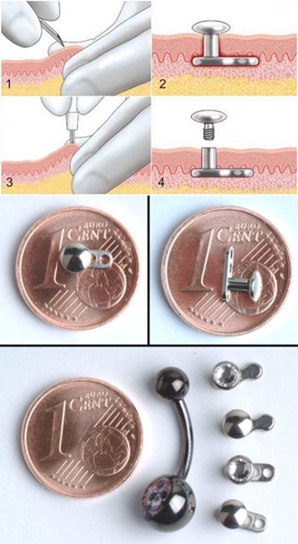 Microdermal piercing : 미세 박피술을 만드는 방법 (사진)