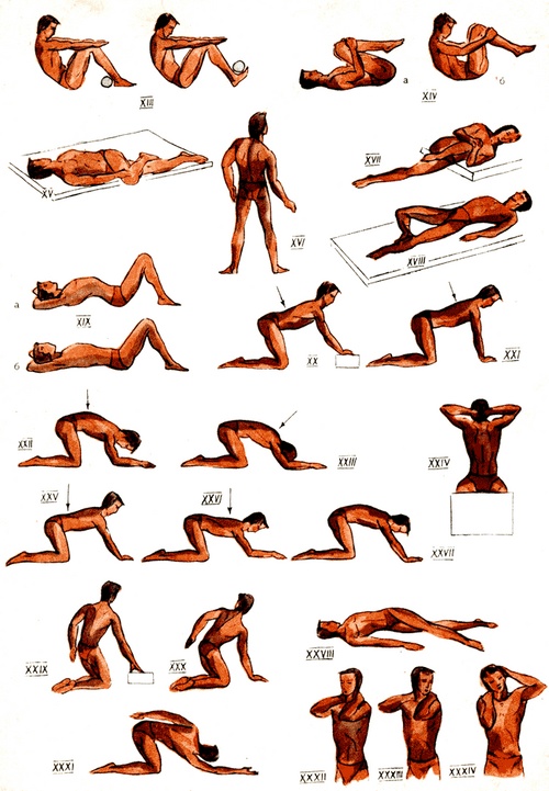 척추 측만증 치료를위한 운동의 복잡